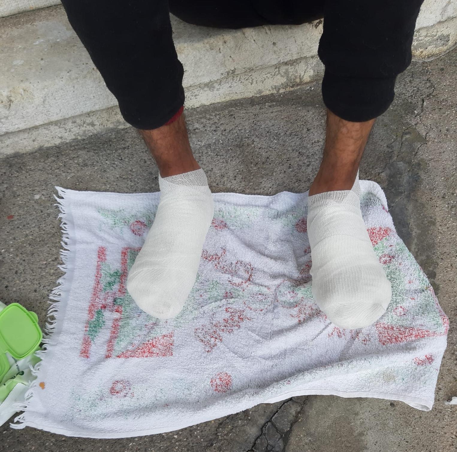 Piedi dei migranti fasciati dai volontari a Trieste. Credits: Linea d'Ombra